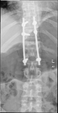 spine2